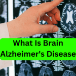 What Is Brain Alzheimer's Disease